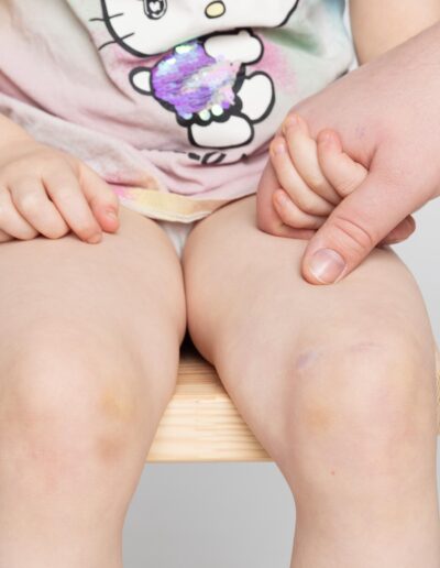 vurderingsfoto til forsikringsselskab